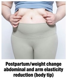 Thermage FLX target area — post-childbirth or weight-change abdomen and arm laxity