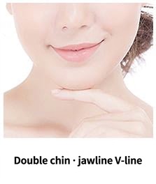 Thermage FLX target area — double chin and V-line jaw