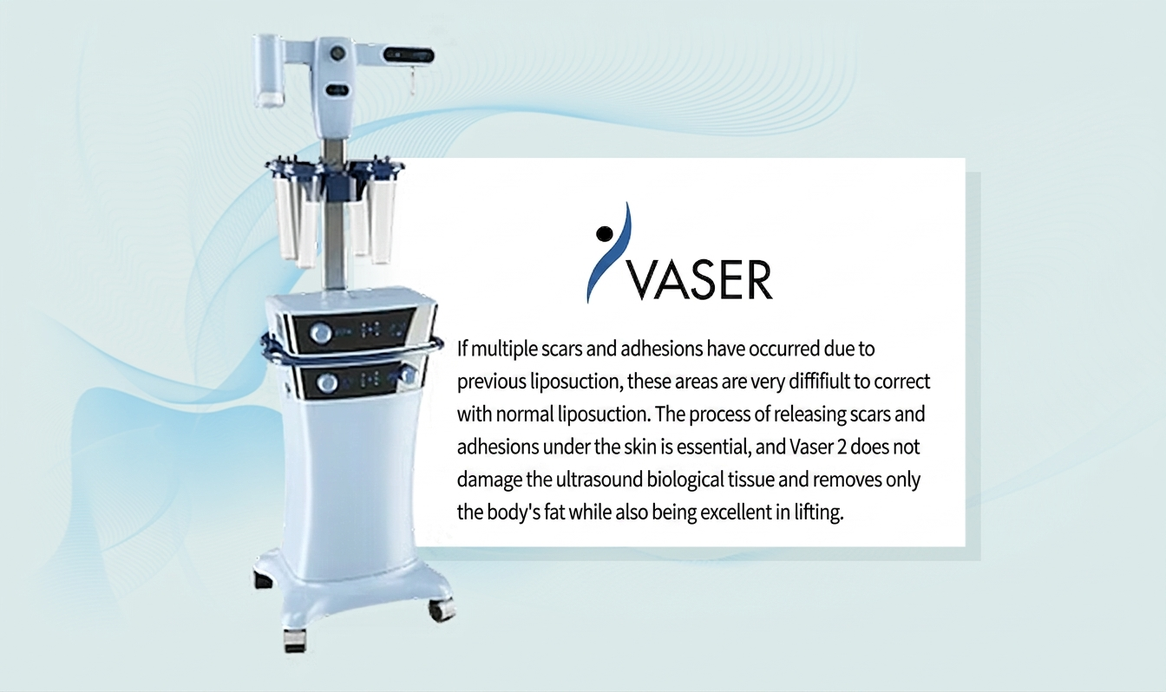 Liposuction side-effect — uneven, lumpy results that require diligent massage care