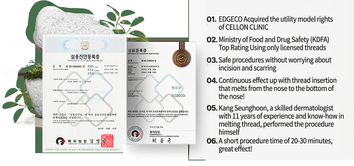 Edge Nose — KFDA-approved devices, absorbable threads, Dr. Kang, 20-30 minute procedure