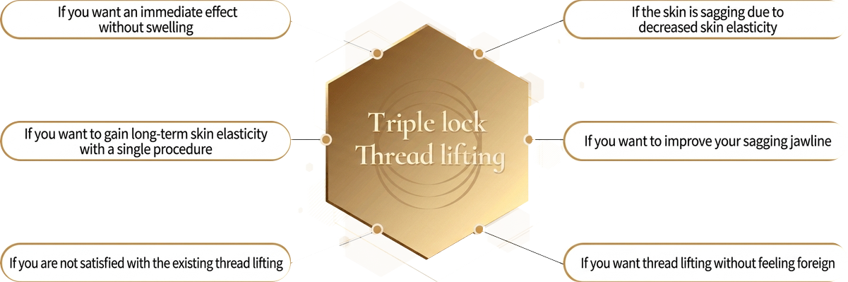 Triple-Lock thread lift — for immediate, foreign-body-free, long-lasting jawline lifting
