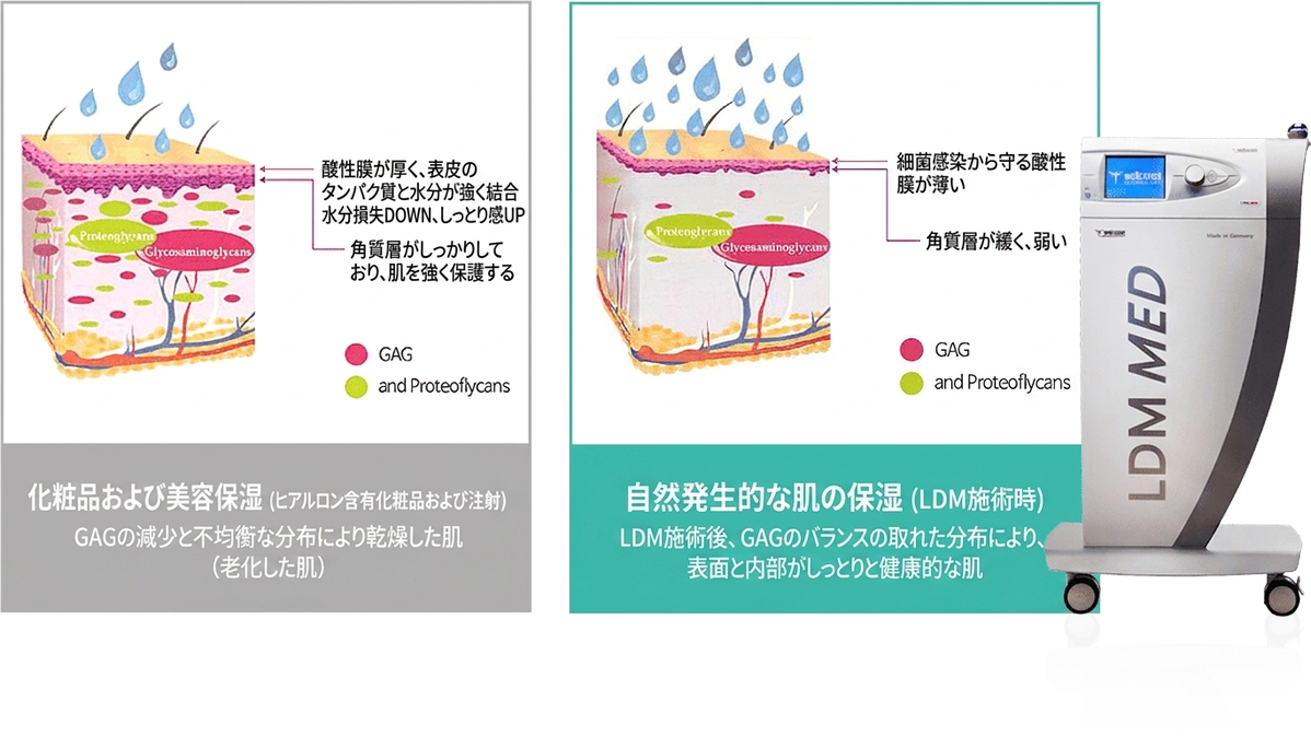 LDMアクアリフティング — GAGの均一分布で潤い健康肌へ(乾燥老化肌との比較)