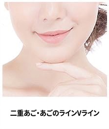 サーマクールFLX対象部位 — 二重あご・あごのVライン