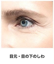 サーマクールFLX対象部位 — 目尻・目元のシワ
