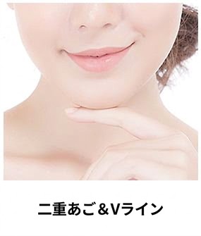 ウルセラプライム対象部位 — 二重あご・Vライン