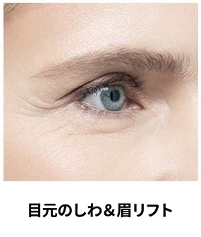 ウルセラプライム対象部位 — 目尻のシワ・眉リフト