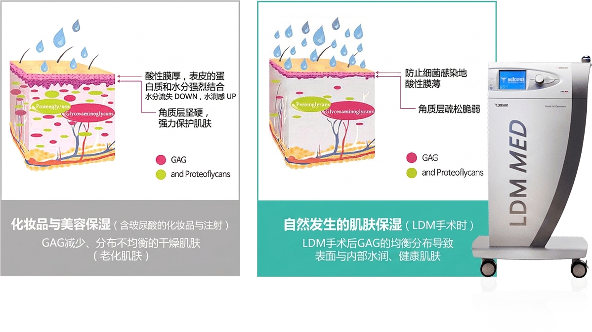 LDM水光提升 — GAG均衡分布带来水润健康肌肤(对比干燥老化肌)