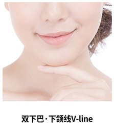 热玛吉FLX适用部位 — 双下巴与下颌V线