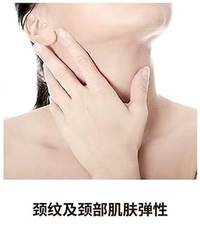 Ultherapy Prime适用部位 — 颈纹与颈部松弛