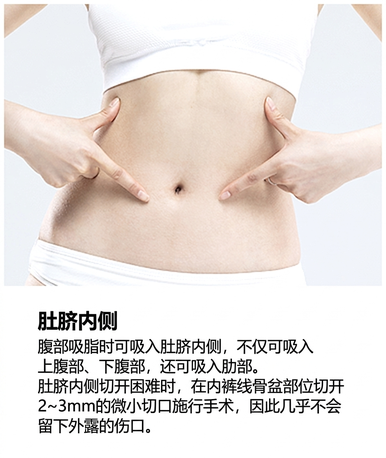 威塑吸脂切口 — 肚脐内侧,覆盖腹部与腰侧
