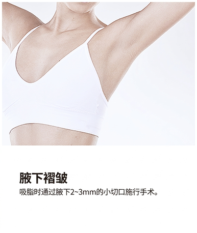 威塑吸脂切口 — 腋下内侧,塑造手臂轮廓
