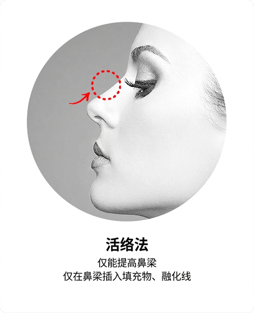 传统用线方式 — 仅垫高鼻梁