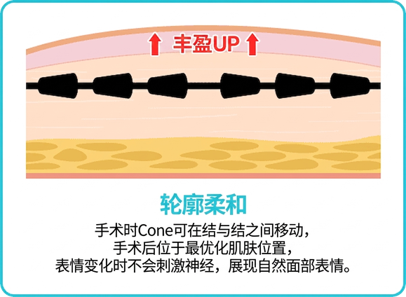 Silhouette Soft — 锥体在结间移动，表情自然